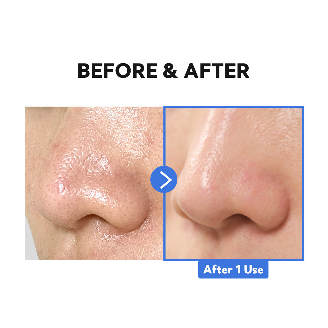 Hydro Boost Enzyme Cleansing Bálsamo